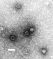 Poliovírus